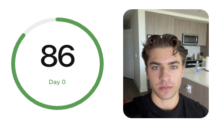 Baseline check-in with a Day 0 score and photo